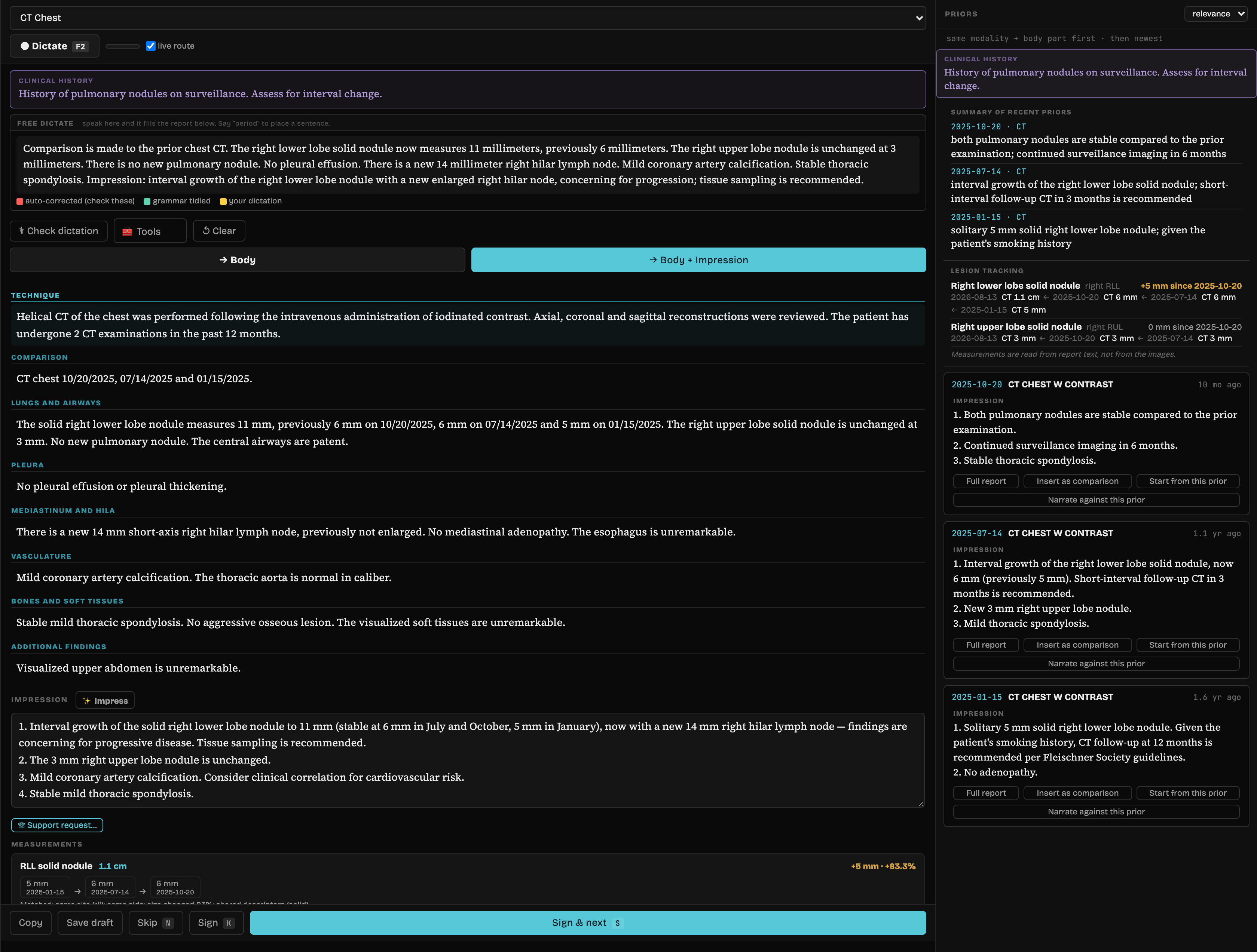 The whole dictation page: clinical history, a free-dictate box with colour-coded corrections, the report from Technique through Additional findings, a composed four-item impression, the measurement chain running 5 mm to 11 mm across four dated studies, and a priors rail carrying the summary of recent priors, lesion tracking and three prior impressions with insert-as-comparison and start-from-prior actions.